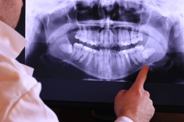 Best Emergency Dentist for Knocked-Out Tooth in Tipton, IN